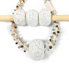 Focal Beads